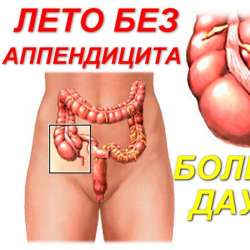 Игорь Кэ-Лето без аппендицита