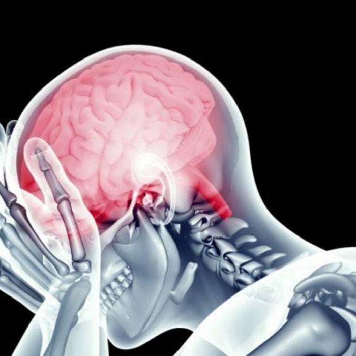 ПИРРАПИР-Термоневроз