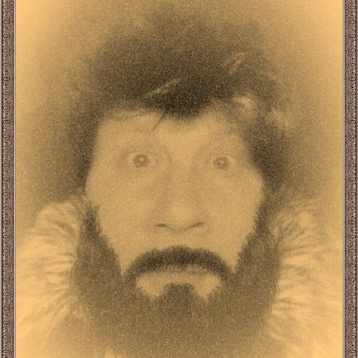 Болезнь Дауна-РОКЕНРОЛЬНЫЙ ДЯДЯ